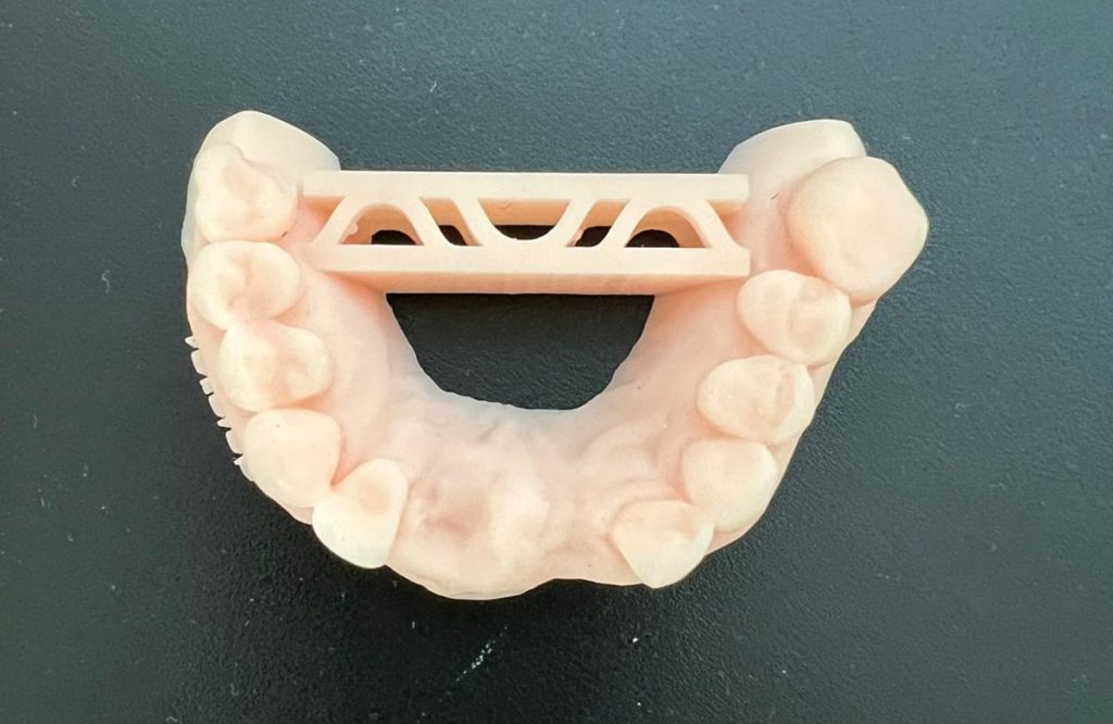 impresión digital de las prótesis dentales